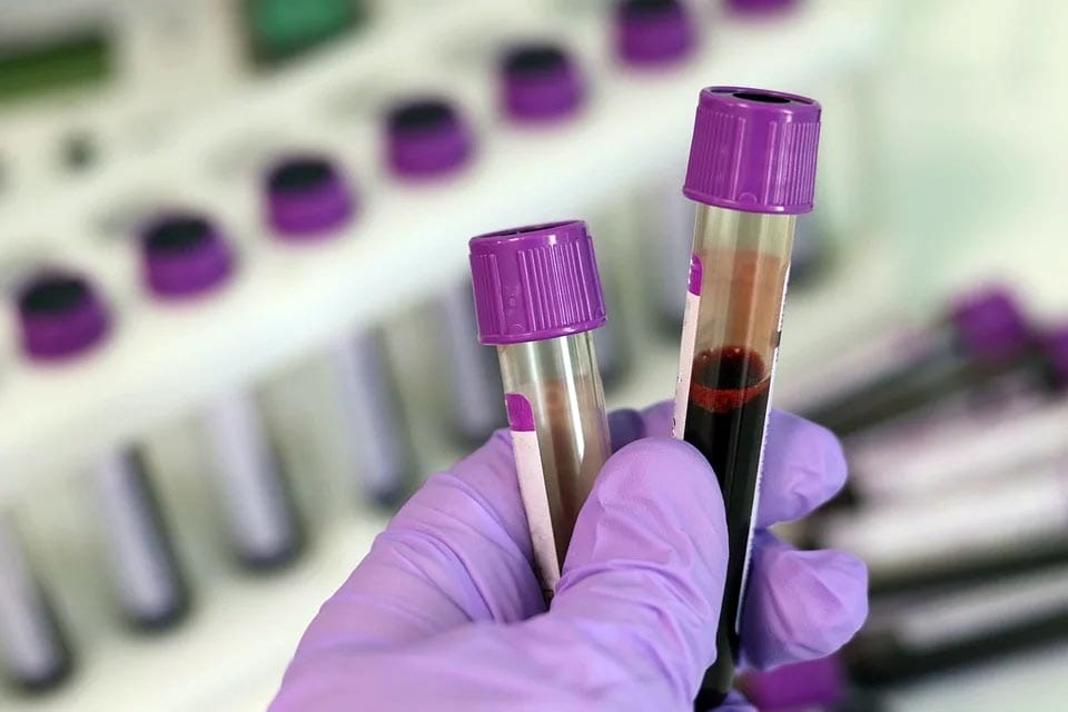Planos de saúde vão cobrir testes para novo coronavírus