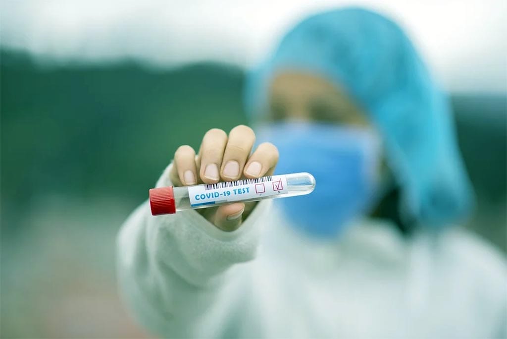Covid-19: Fiemg e indústrias do Vale do Aço alertam que pandemia não acabou