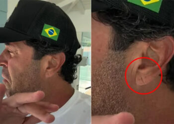 Morte de influencer reacende alerta sobre infartos silenciosos e o chamado sinal de Frank