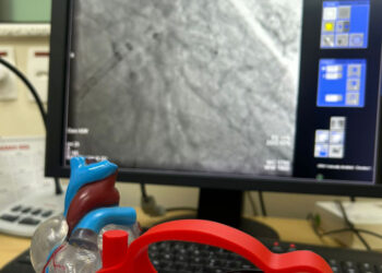 HMC realiza procedimentos inéditos e amplia inovação em cardiologia intervencionista